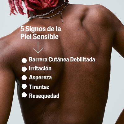 5 Signos de Sensibilidad Cut&aacute;nea